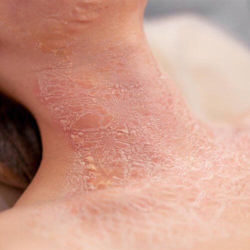 close up of neck skin condition 2026 09 22 23 09 03 utc